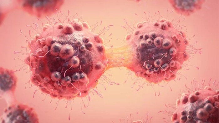 Tumore al colon: scoperto un meccanismo alla base della formazione delle metastasi