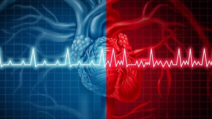 Fibrillazione atriale: anticoagulanti sempre fondamentali