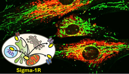 Importanti progressi nella comprensione delle malattie neurodegenerative